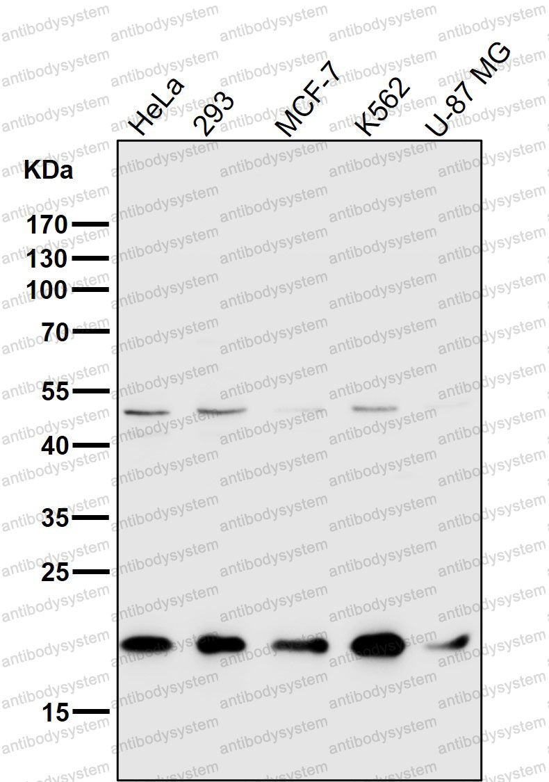 Anti-TOMM22 Antibody (R2N27)