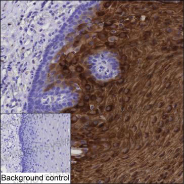 Anti-CRNN Antibody (R3Z61)