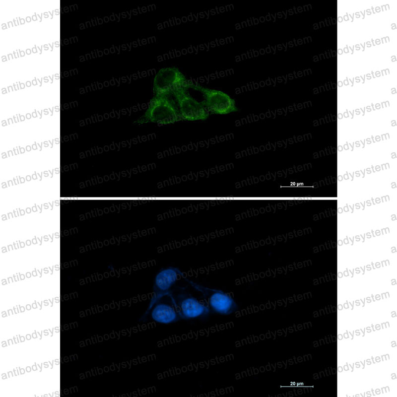 Anti-NDUFAF4 Antibody (R2N28)