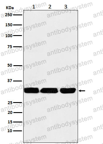 Anti-TP53INP1 Antibody (R2N30)