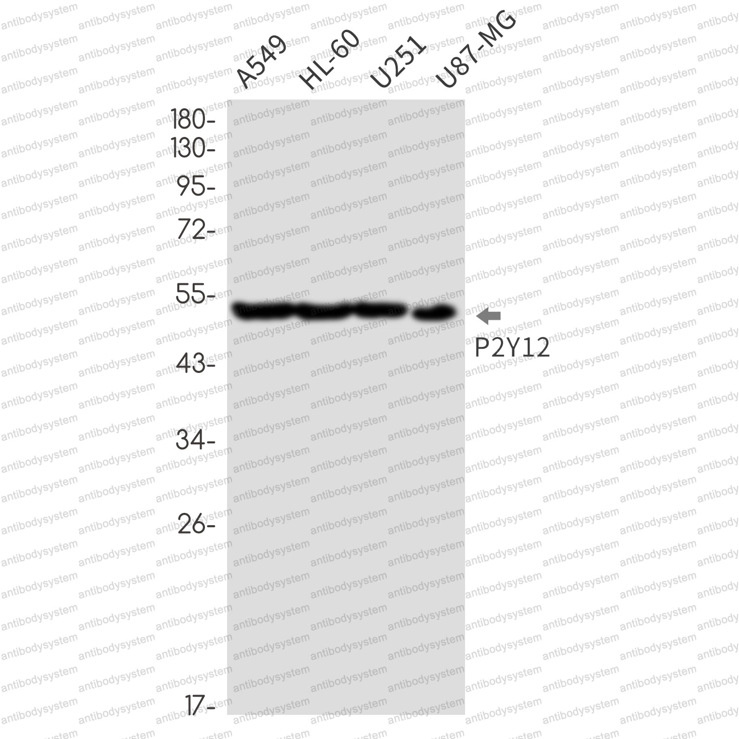 Anti-P2RY12 Antibody (R2N31)