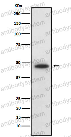Anti-WNT5B Antibody (R2N32)