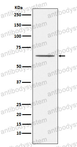 Anti-RTN4R/NgR1/Nogor Antibody (R2N33)