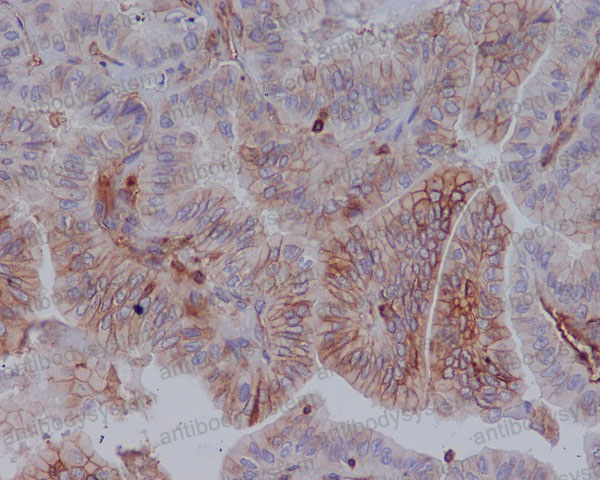 Anti-HLA-A Antibody (R1A87)