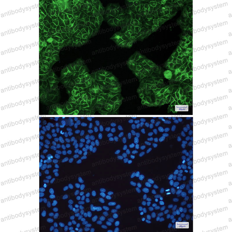 Anti-HLA-A Antibody (R2N35)