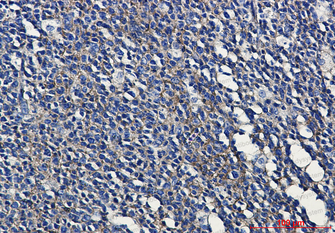 Anti-HLA-A Antibody (R2N36)