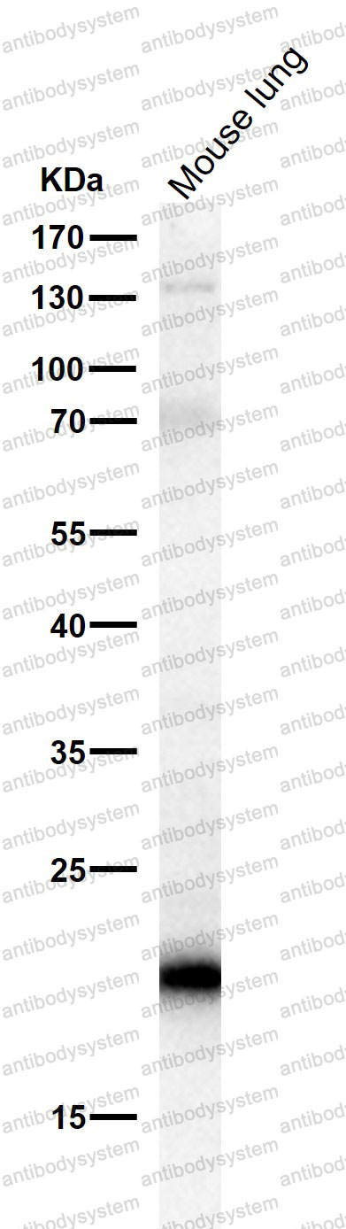 Anti-HLA-B Antibody (R2N37)