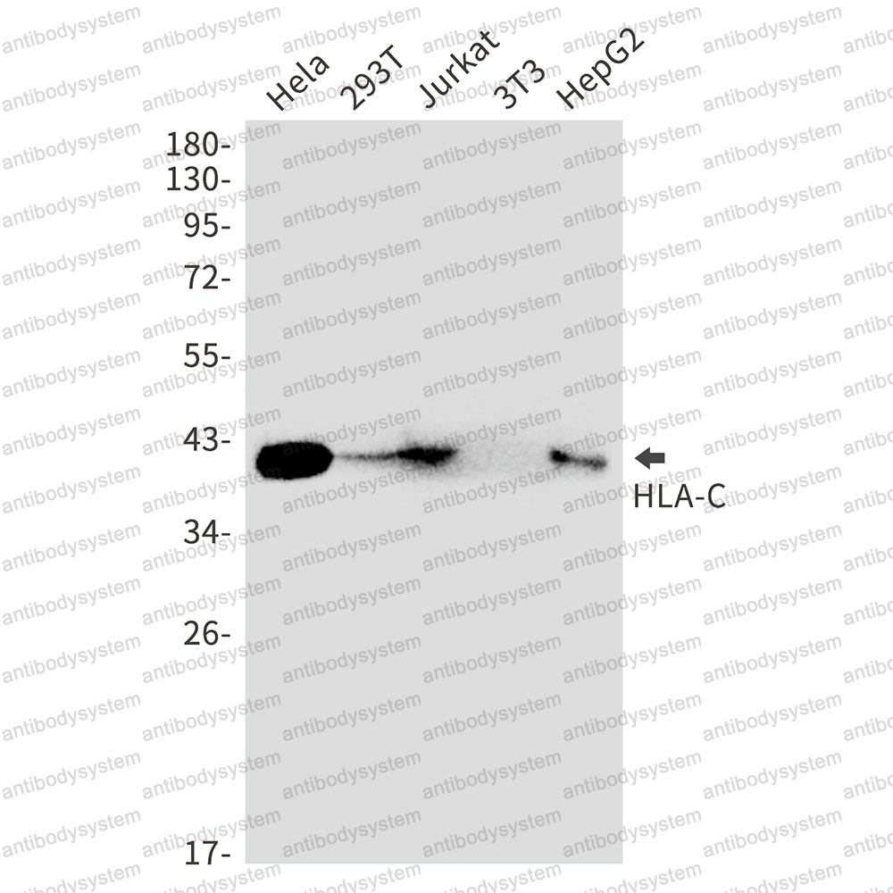 Anti-HLA-C Antibody (R2N38)