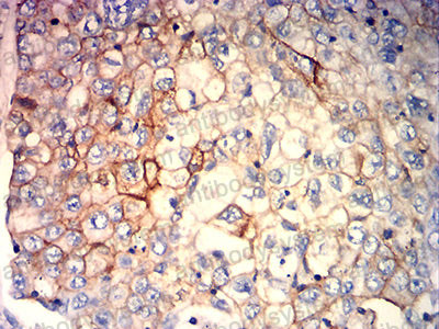 Anti-HLA-C Antibody (R3Z71)