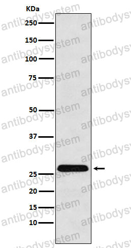 Anti-HLA-DRB4 Antibody (R2N40)