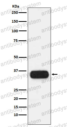 Anti-HLA-DQA1 Antibody (R2N41)