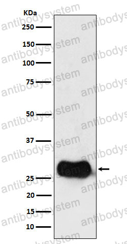 Anti-HLA-DMB Antibody (R2N42)