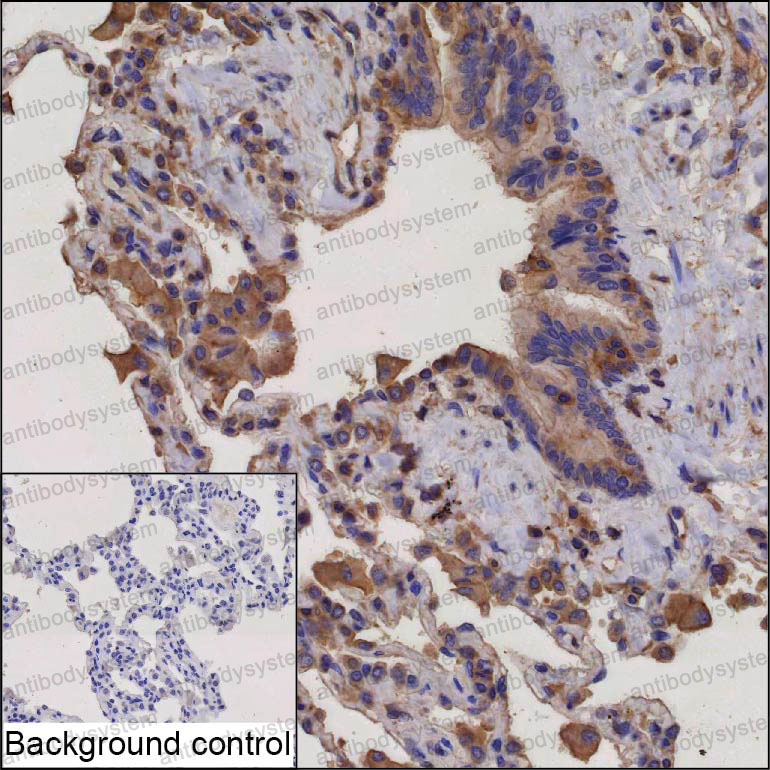 Anti-CLEC1A Antibody (R3Z84)