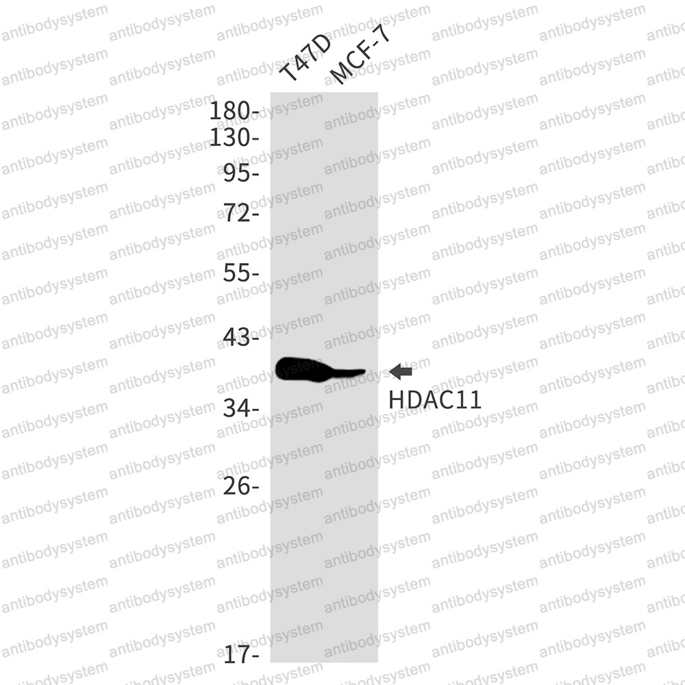 Anti-HDAC11 Antibody (R2N44)