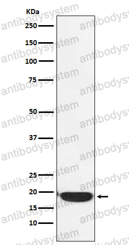 Anti-PERP Antibody (R2N45)