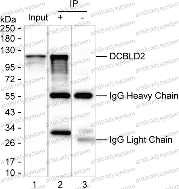 Anti-DCBLD2/CLCP1 Antibody (R3Z87)