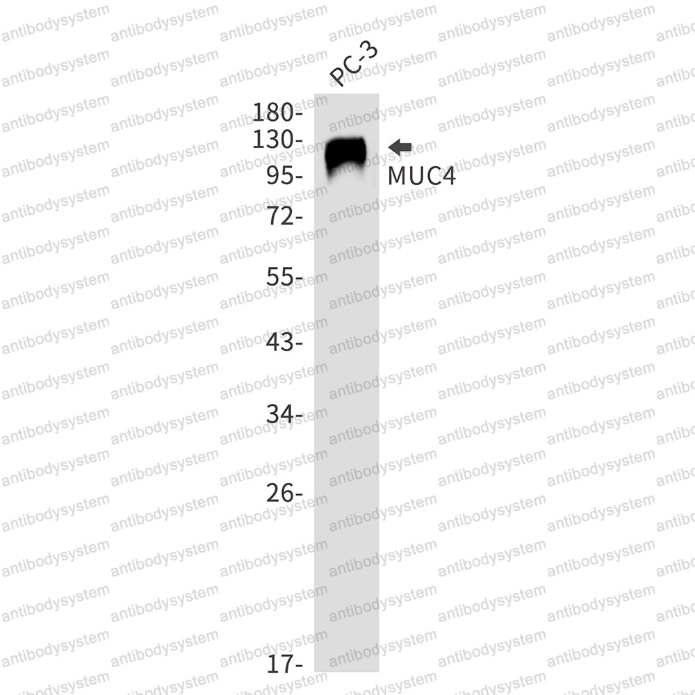 Anti-MUC4 Antibody (R2N47)