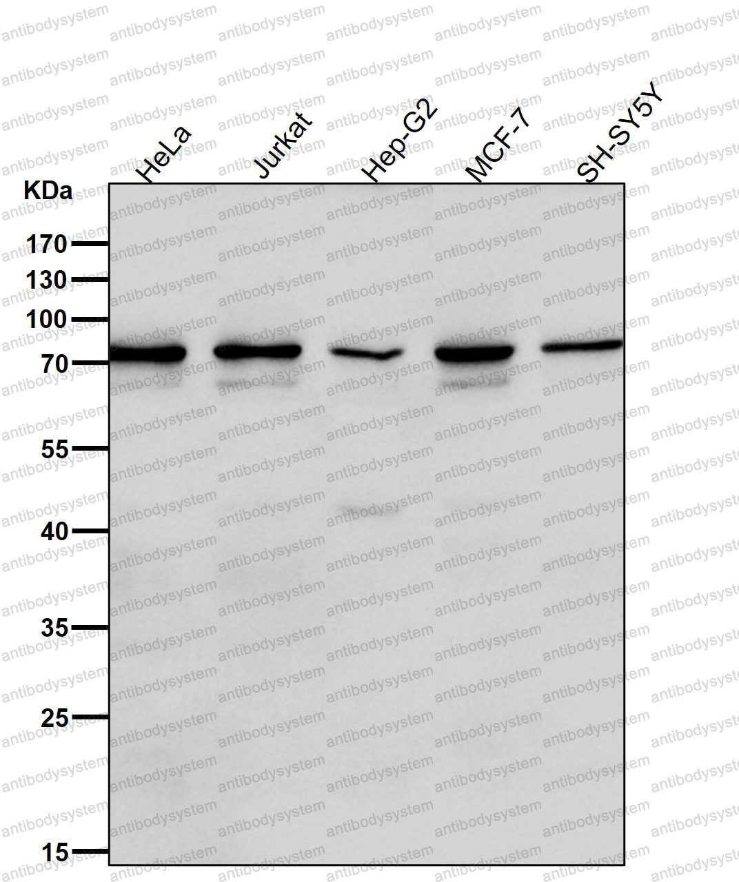 Anti-FZD8 Antibody (R2N48)