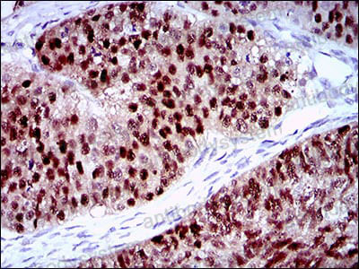 Anti-PLAGL1 Antibody (R3Z90)