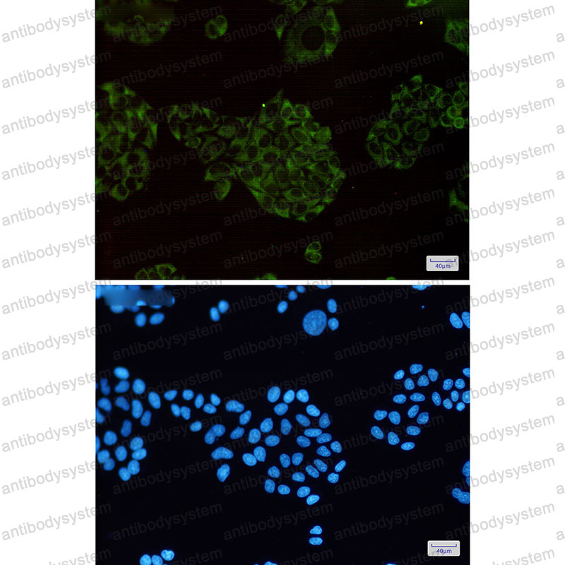 Anti-MAP3K2 Antibody (R2N50)