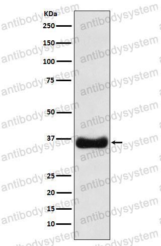 Anti-OLIG1 Antibody (R2N53)