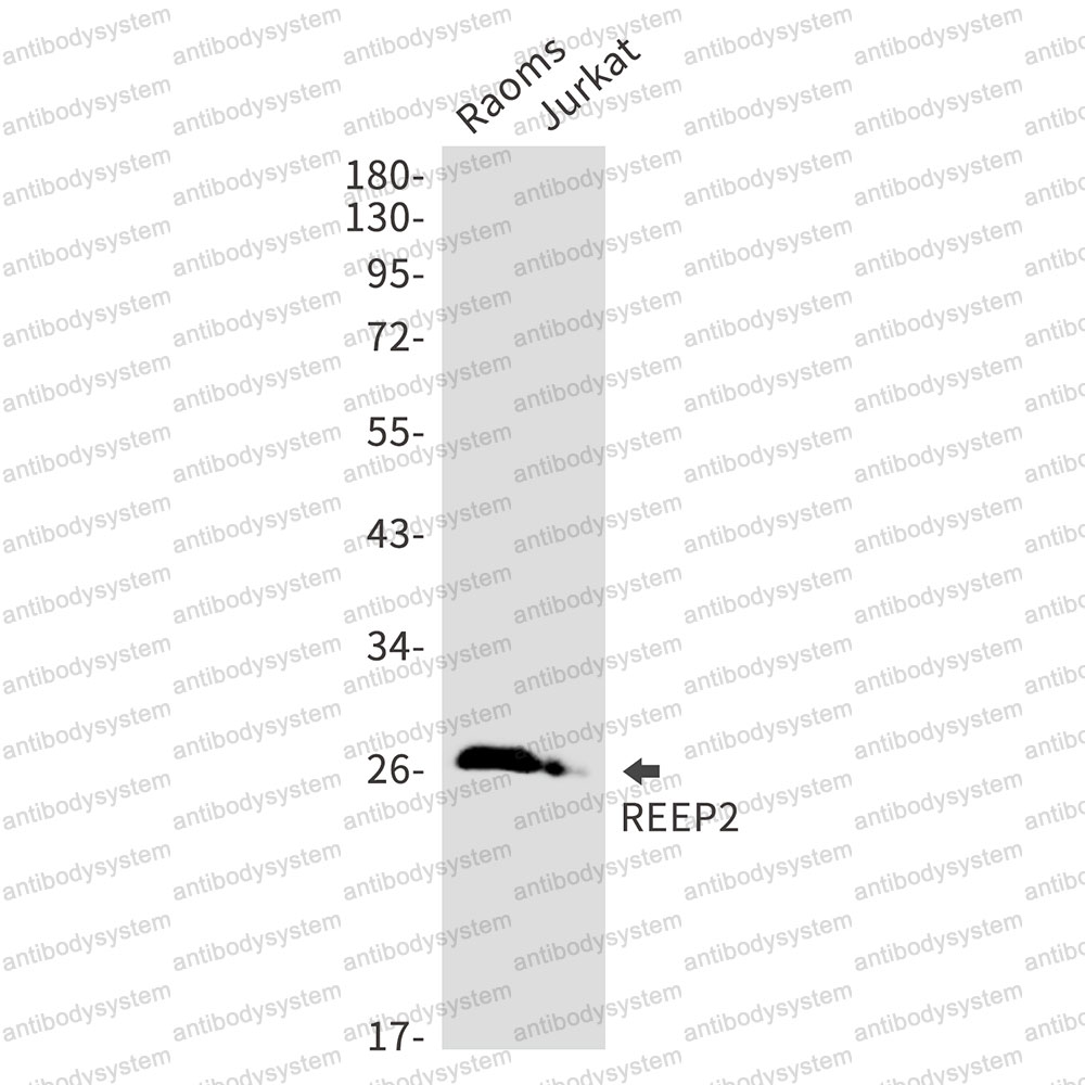 Anti-REEP2 Antibody (R2N56)