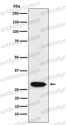 Anti-MXD3 Antibody (R2N57)