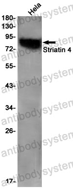 Anti-STRN4 Antibody (R2N59)