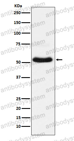Anti-SLC17A7 Antibody (R2N60)