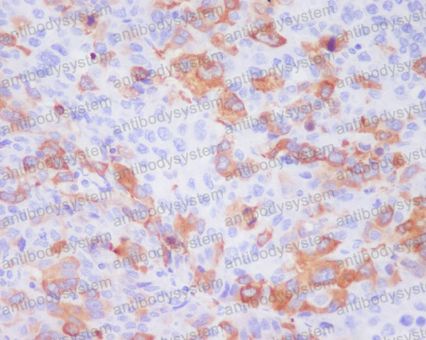 Anti-TACC3 Antibody (R1A60)