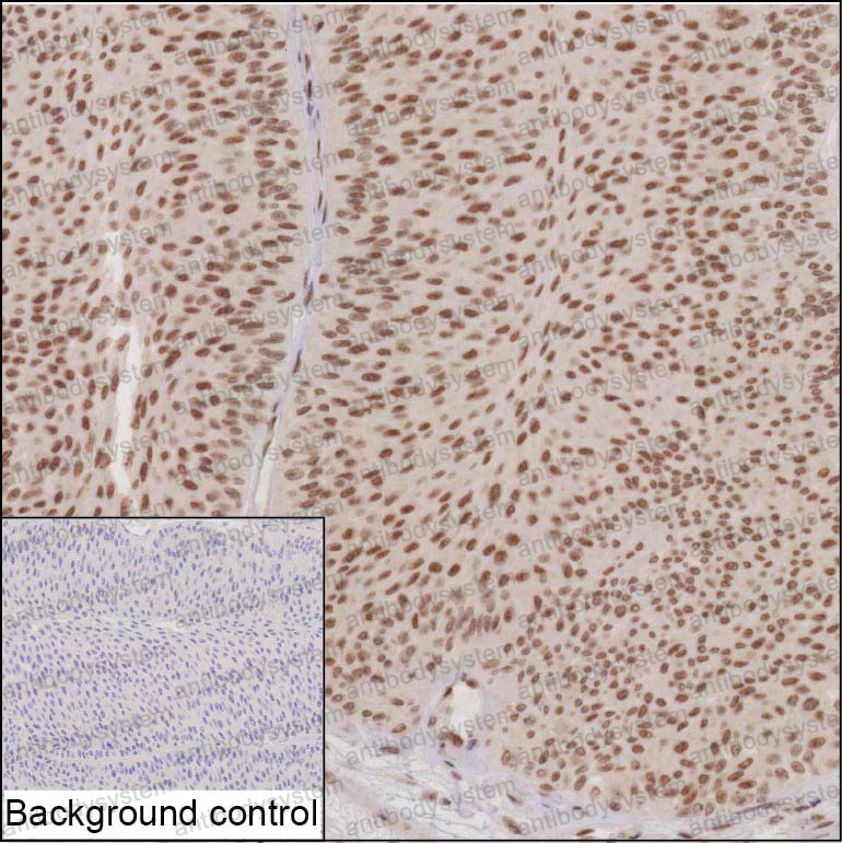 Anti-RNF2 Antibody (R4A04)