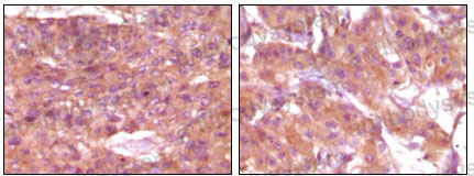 Anti-SRA1 Antibody (R4A06)