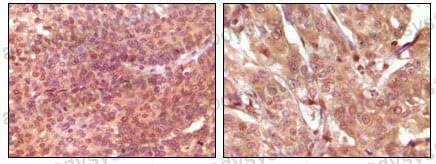 Anti-SRA1 Antibody (R4A07)