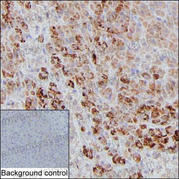 Anti-ASPM Antibody (R4A12)