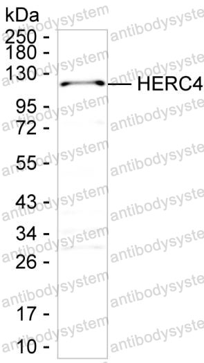 Anti-HERC4 Antibody (R4A13)