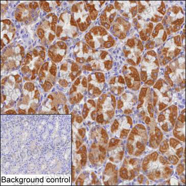 Anti-CHCHD6 Antibody (R4A16)