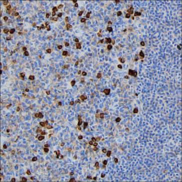 Anti-JCHAIN Antibody (R4A19)