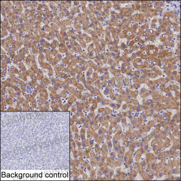 Anti-MMAB Antibody (R4A20)