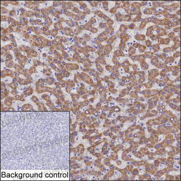 Anti-MMAB Antibody (R4A21)