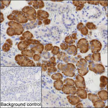 Anti-ARFGAP3 Antibody (R4A22)