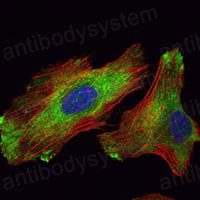 Anti-WIF1 Antibody (R4A23)