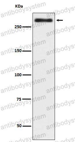 Anti-TLN2 Antibody (R1A83)