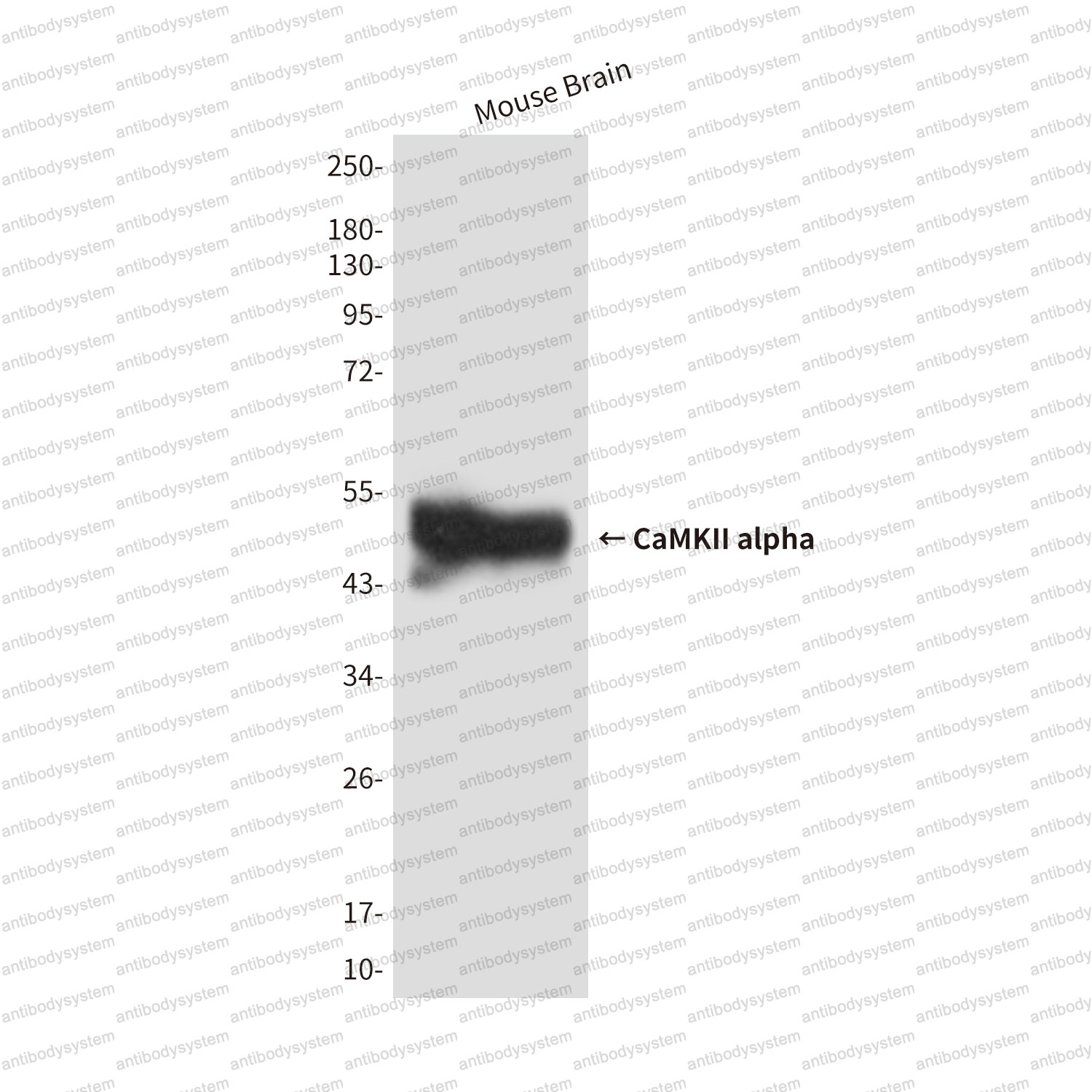 Anti-CAMK2A Antibody (R4A24)