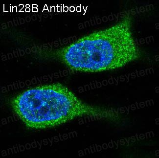 Anti-LIN28B Antibody (R1C39)