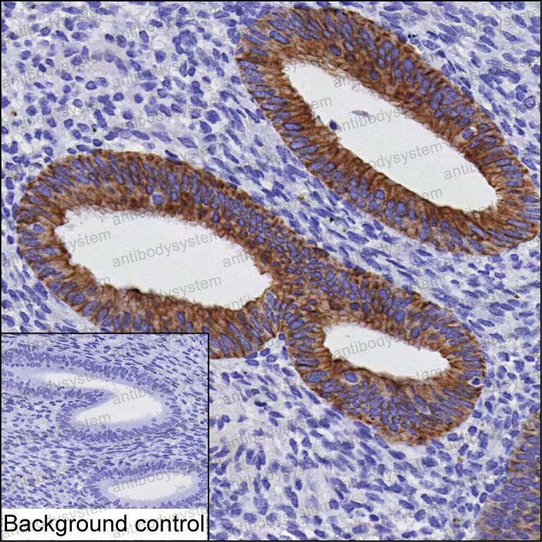Anti-IKBKG Antibody (R4A25)