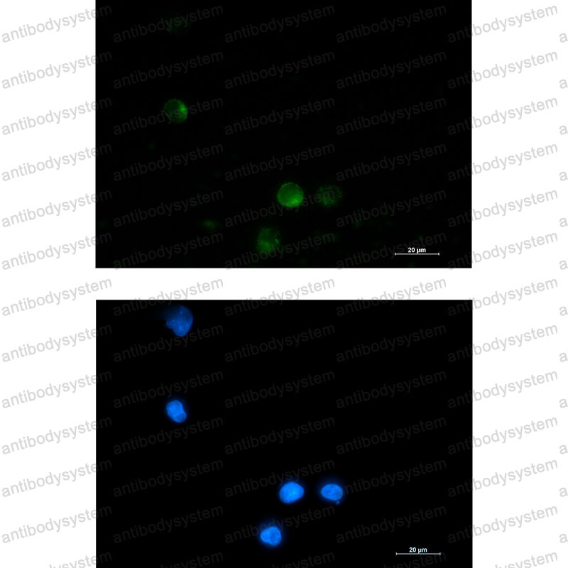 Anti-SSX2IP Antibody (R2P99)