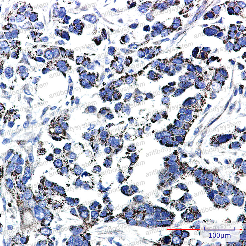 Anti-TXNRD2 Antibody (R2Q18)