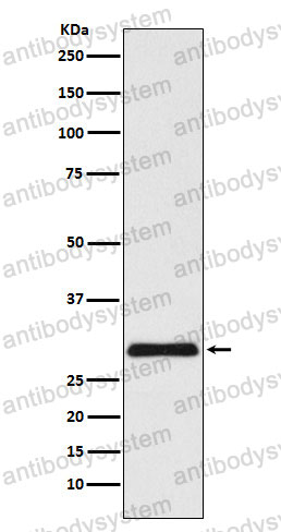 Anti-CHMP3 Antibody (R2Q19)