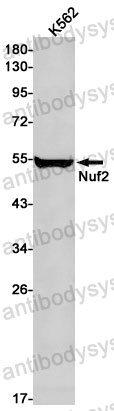 Anti-NUF2 Antibody (R2Q21)