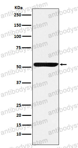 Anti-NUF2 Antibody (R2Q20)